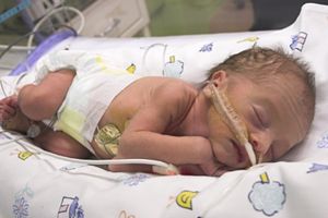 Spitalul Judeţean va avea compartiment de terapie intensivă pentru copii