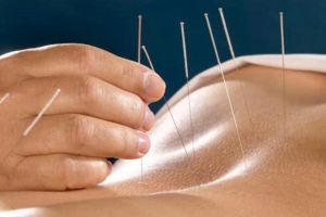 Zeci de boli tratate prin acupunctură, o metodă terapeutică milenară, la MedClinic Suceava