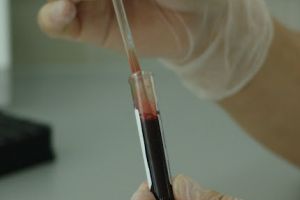 Copil în vârstă de un an, confirmat cu coronavirus