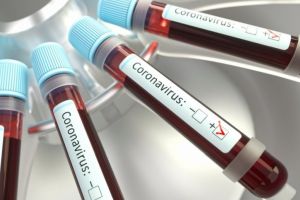 COVID-19 se extinde: Primul caz de Coronavirus CONFIRMAT la nivelul judeţului Bistriţa-Năsăud