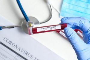 Problema testărilor pentru Covid-19 rezolvată în judeţul Mureş!