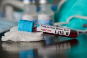 Verdictul cercetătorilor chinezi: Ce grupă de sânge 'atrage' virusul ucigaş