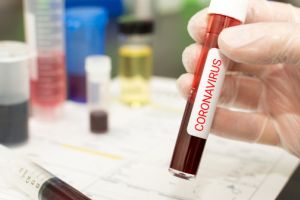 Măsuri Covid-19 în industria serviciilor pentru afaceri: angajaţii lucrează de acasă în 98% dintre companii