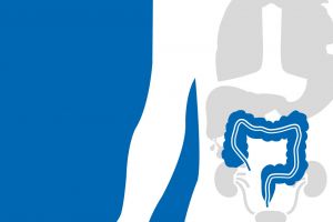 Cancerul colorectal – Simptome, factori de risc, tratament