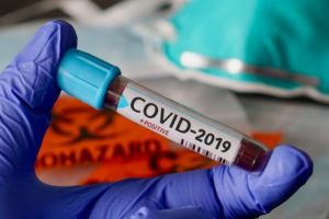 2 milioane de teste pentru Covid-19, aşteptate în România!
