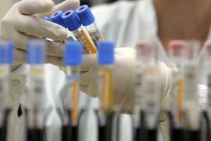 Un studiu medical arată modul în care sistemul imunitar contribuie la vindecarea de Covid-19