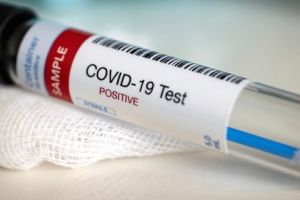 UMFST Târgu-Mureş începe testările pentru Covid-19!