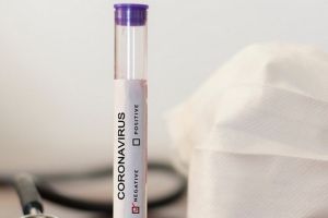 Testarea personalului secţiilor de Boli Infecţioase din Oradea: de la medici la îngrijitoare, toţi angajaţii verificaţi sunt sănătoşi