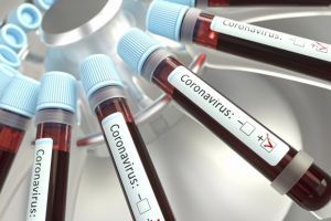 Încă 3 decese ale unor persoane infectate cu noul coronavirus, numărul total ajungând la 29