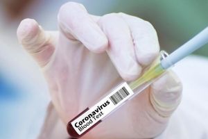 Record de diagnosticări în România: 308 cazuri de coronavirus, confirmate în ultimele 24 de ore! Numărul deceselor a ajuns la 38