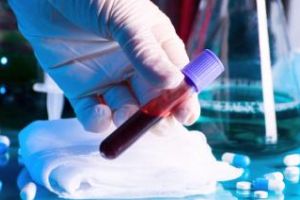 Situaţia cazurilor de coronavirus din România, duminică 29 martie. 308 cazuri noi, 42 de decese