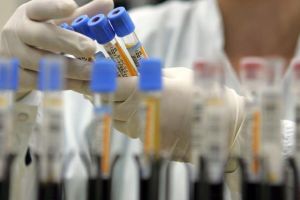 România are 2.245 de cazuri de coronavirus – Avem şi o veste bună: 220 s-au vindecat