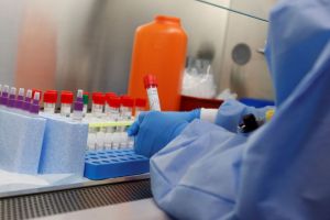 SURSE: Aproape 100 noi testări făcute la Oradea, 5 noi cazuri depistate. Dintre bolnavi, patru sunt la Terapie Intensivă