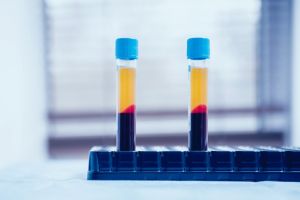 Pacienţii critici cu coronavirus şi medicii din România vor beneficia de un tratament cu plasmă umană hiperimună