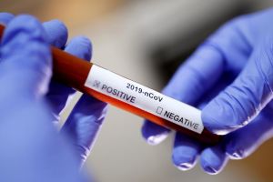 RAPORTAREA OFICIALĂ: 46 de cazuri confirmate de coronavirus în judeţul Bihor