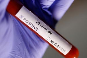Al treilea deces în Galaţi, cauzat de coronavirus, a fost infirmat de autorităţi