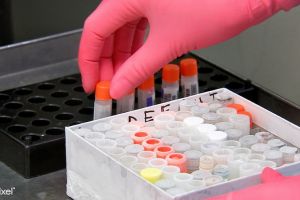 Record de 190 de testări pentru coronavirus într-o singură zi în Bihor: 4 noi cazuri şi o persoană vindecată!