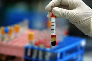 Cum e cu imunizarea? Doi români infectaţi cu coronavirus au fost reconfirmaţi după ce au fost externaţi