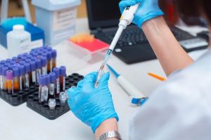În Bihor a început testarea comunitară pentru coronavirus! Se foloseşte metoda 