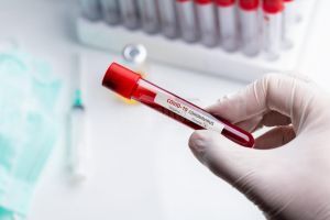 Suceava: 85 de cazuri noi de infecţie cu COVID-19