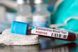 Covid-19. Algoritm nou de testare, internare şi externare!