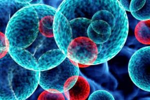 Leucemia limfatică cronică – Cauze, simptome, tratament