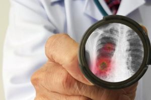 România: 6.879 de persoane infectate cu virusul COVID, 1.051 vindecate şi externate