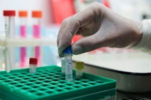 DSP Covasna: Peste 10% din testele COVID-19 efectuate până în prezent sunt pozitive