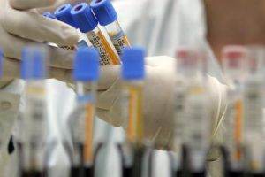 Situaţia Covid-19 în Mureş: cazuri confirmate, în carantină, vindecate şi amenzi!