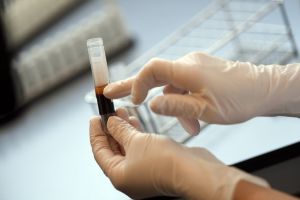 Tratamentul cu plasmă, în rândul pacienţilor critici, infectaţi cu COVID-19, va fi folosit şi în România. Anunţul făcut de ministrul Sănătăţii