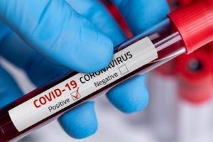 PREMIERĂ. Pacienţii unui spital din România, testaţi pentru Covid-19 la internare!