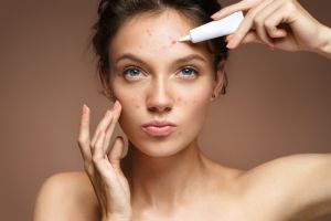 Acneea – Cauze, simptome şi remedii. Cum o prevenim?
