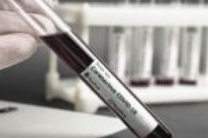 Coca-Cola donează Spitalului Municipal din Timişoara un aparat prin care se reduce timpul testării pentru COVID-19