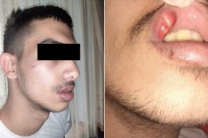 FOTO: Copil bătut cu bestialitate de paznicii unui magazin din Sibiu – „M-au lovit cu pumnii şi picioarele până la sânge”