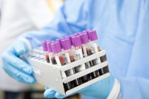 Coronavirus: Rezultate negative pentru 20 de persoane din Fărcaşa