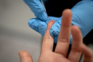 Teste pentru determinare anticorpi IgM şi IgG anti COVID 19 în Focşani