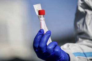 Încă 8 clujeni depistaţi pozitiv cu COVID-19