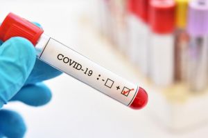 COVID Satu Mare. Aproape 2.000 de persoane testate în judeţ