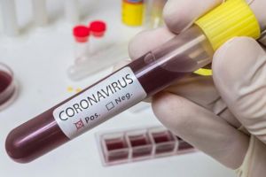 În ultimele 24 de ore au fost confirmate 65 de cazuri noi de COVID-19 în judeţul Suceava