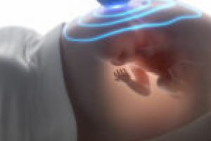 Cazul unic în România îşi păstrează unicitatea! Femeia cu HIV şi COVID -19 a născut un copil sănătos