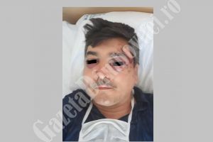 NUCET: Bărbat snopit în bătaie de patru indivizi! Un altul este rănit! Poliţiştii i-au reţinut pe agresori