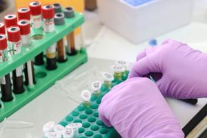 262 de cazuri de Covid-19 confirmate în Bistriţa-Năsăud, inclusiv la încă un poliţist. Alte 9 persoane vindecate. Situaţia la SAJ