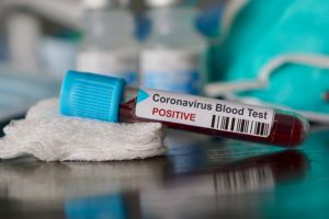 Alte cinci decese anunţate miercuri dimineaţă – Avem 1007 morţi în România din cauza coronavirusului