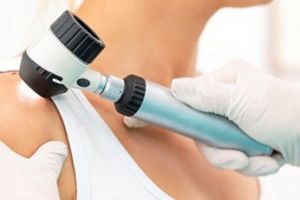 Mai, luna conştientizării riscului de MELANOM. Adresaţi-vă cu ÎNCREDERE Policlinicii AS