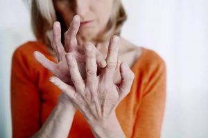 Poliartrita reumatoidă – Cauze, simptome, diagnostic, tratament