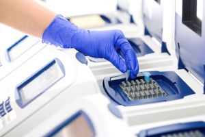 Când începe şi cum se va desfăşura testarea imunologică în România