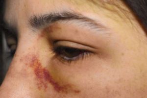 Tânără însărcinată, exploatată sexual, lovită cu maşina şi bătută cu toporul