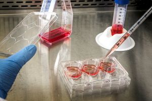 Coronavius în Bihor: Peste 82% dintre pacienţii infectaţi s-au vindecat. Un singur caz depistat în ultimele 24 de ore
