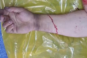Bărbat rănit într-un accident de muncă, la Braşov