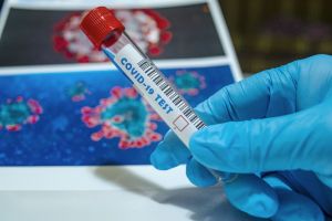 Coronavirus în Bihor: 81 de cazuri active vineri dimineaţă. Procentul vindecaţilor: 82,92%
